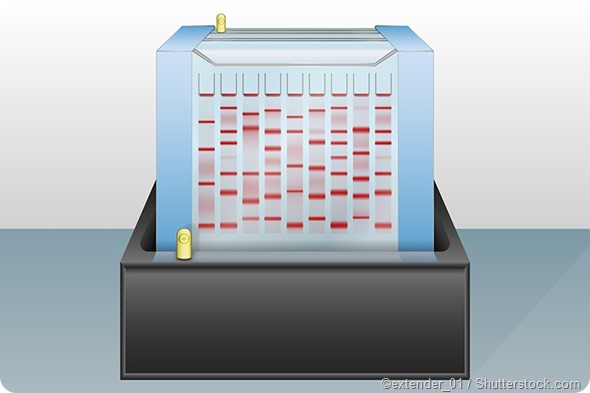 Gel electrophoresis
