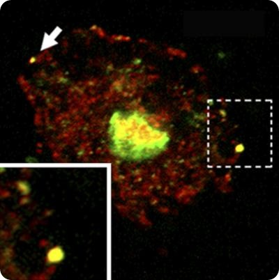 Kyei et al. found that the HIV Gag protein (green) localized to autophagosomes (red). Another HIV protein, Nef, blocks the later stages of autophagosome maturation to allow full Gag processing and increase viral yield. Credit: Kyei, G.B., et al. 2009. J. Cell Biol. doi:10.1083/jcb.200903070
