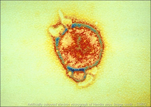 Artificially coloured electron micrograph of Hendra virus: Image credit – CSIRO