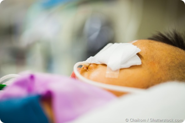 Patients with nasogastric tube