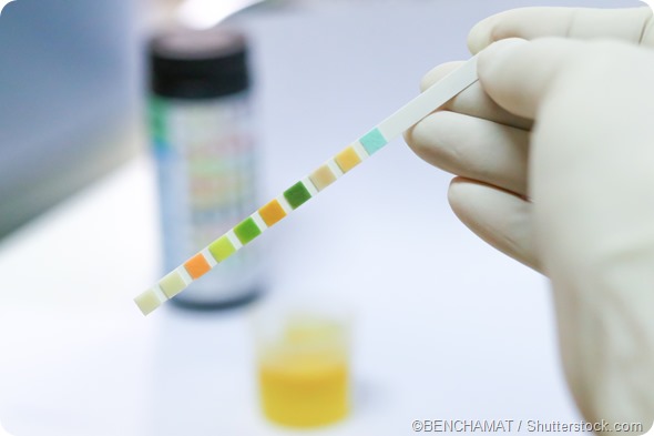 Urine test