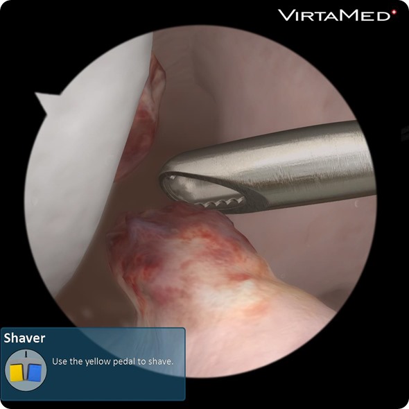 VirtaMed_ArthroS_Knee_ACL_screenshot_01