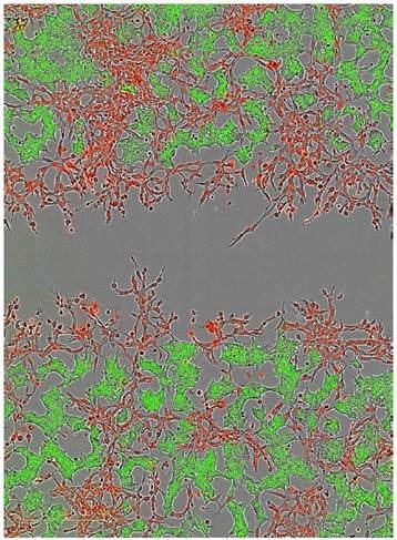 Two color fluorescent scratch wound