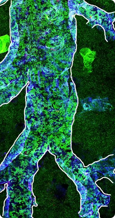 This section of a normal chimeric airway shows a patch distribution of mixed green fluorescent protein positive (green) and negative cells. Credit: Cancer Research UK