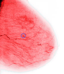 Air pollution, and especially particulate matter, thickens the blood and boosts inflammation, finds experimental research in Occupational and Environmental Medicine.