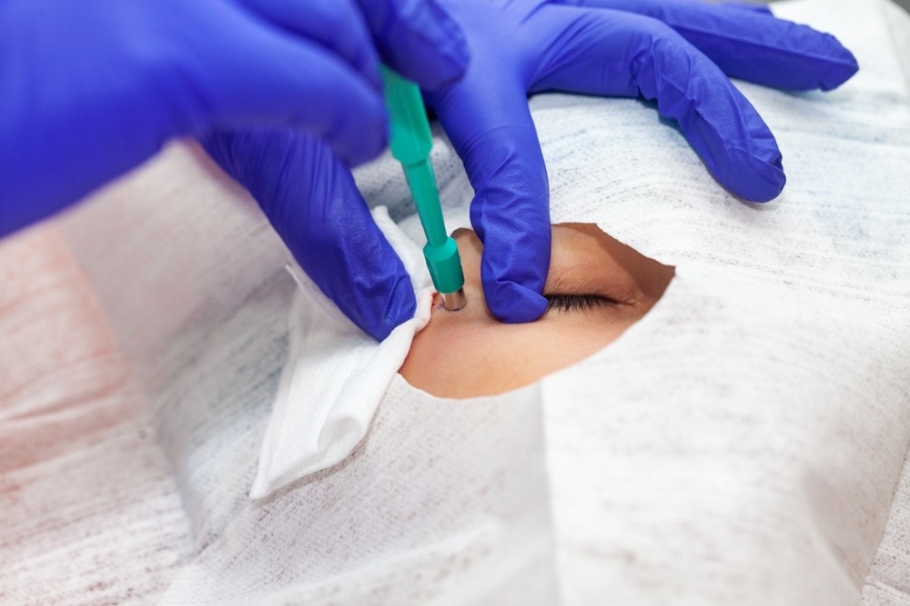 A medical professional wearing blue gloves performs a minor surgical procedure on a patient
