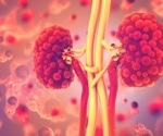 Renal Failure Stages and Symptoms