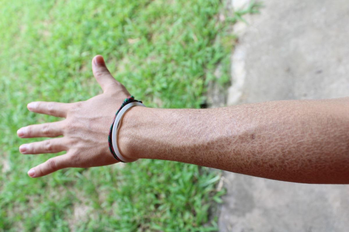 Image Credit: NUGRAHA DIPA/Shutterstock.