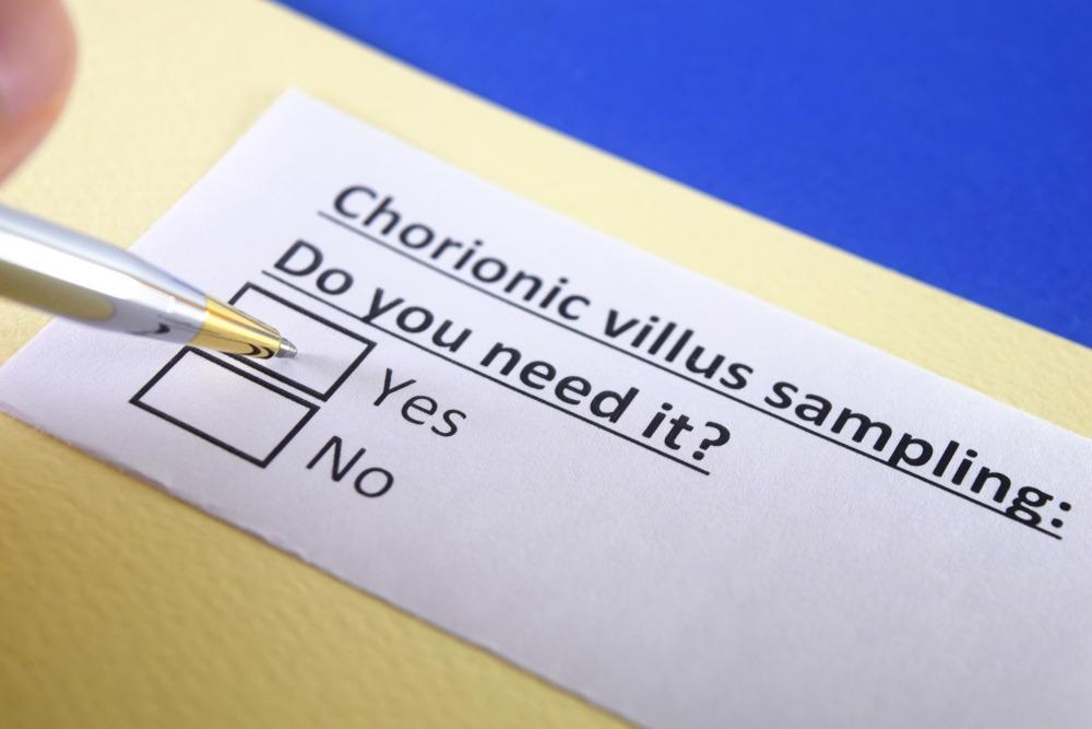 Chorionic villus sampling