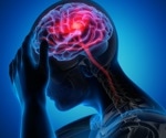 What is Intracranial Hypertension?