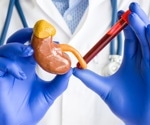 What is Creatinine?