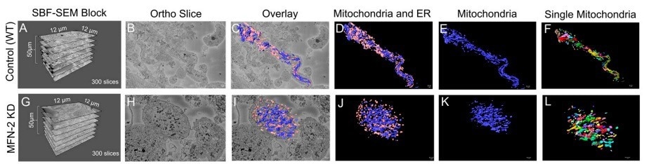Using Amira Software to measure 3D organelle morphology
