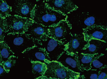 How tumor exosomes communicate cancer progression