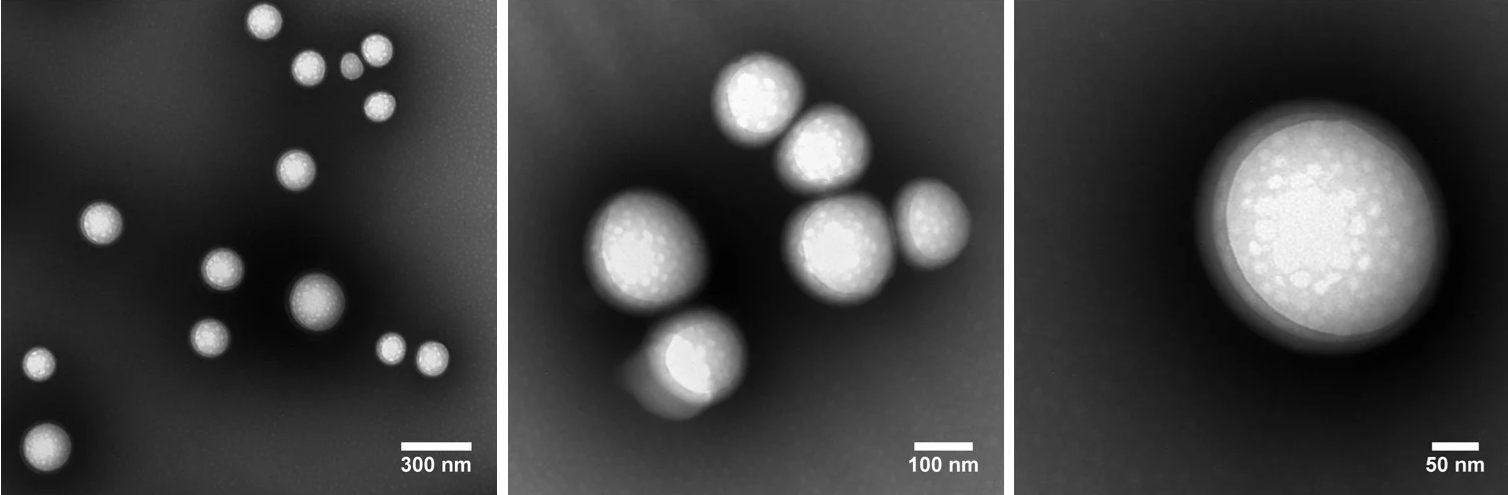 What are the medical applications of PLGA nanoparticles?