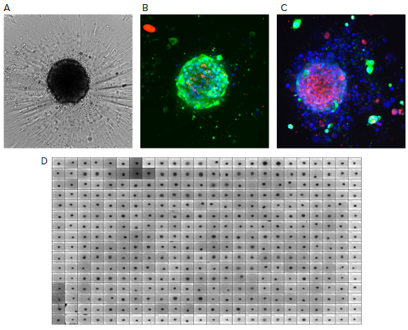 Reference images of tumoroids. A) Tumoroids formed 48h after plating, TL images (10X); B) Composite fluorescent images of untreated tumoroid stained with calcein AM (green), EthD-1 (red) and Hoechst (blue); C) Tumoroids treated with romidepsin (10 nM). Tumoroids were imaged using confocal option of the automated imaging system, Z-stack of 15 images was taken 10 μm apart, then maximum projection images were created (shown). D) 384 well plate with tumoroids after compound treatment, TL images.