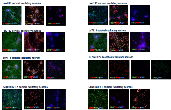 Immunocytochemistry demonstrating the expression of key cortical neuronal markers