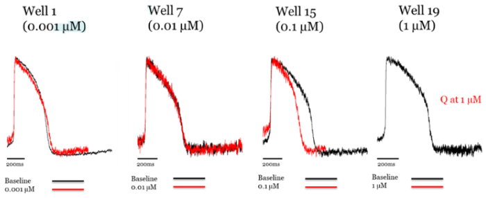Addition of verapamil to axoCells ventricular cardiomyocytes produces hERG blockade at low concentrations, with L type Ca2+ channel block at higher concentrations. Raw trace comparing control (black) to treatment with verapamil (red)