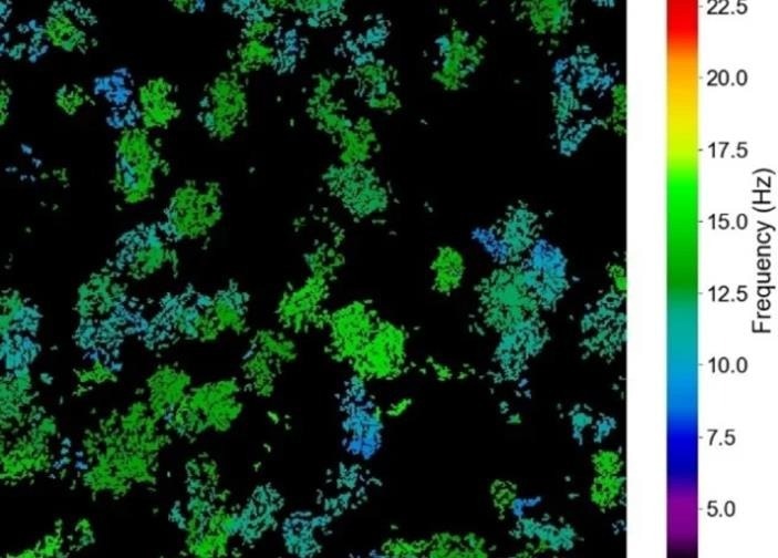 Ciliary Beat Frequency