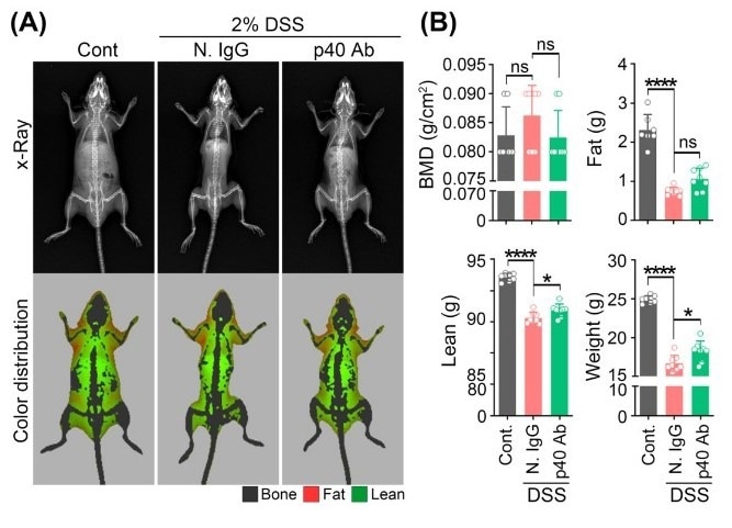 A) Representative D(E)XA images captured on the iNSiGHT system in a mouse model of colitis treated with either IgG or IL-12/23 p40 antibody. B) Body mass index measurements ((bone mineral density (BMD in g/cm2), fat mass (g), lean mass (g), and total weight (g)) of mice treated with either IgG or IL-12/23 p40 antibodies.