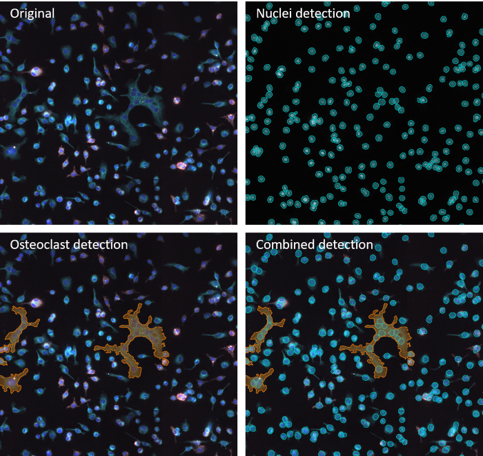 Example of image anaylsis performed by IF Cell Culture - Osteoclast App