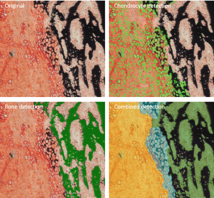 Example of image anaylsis performed by Bone Mineralization App