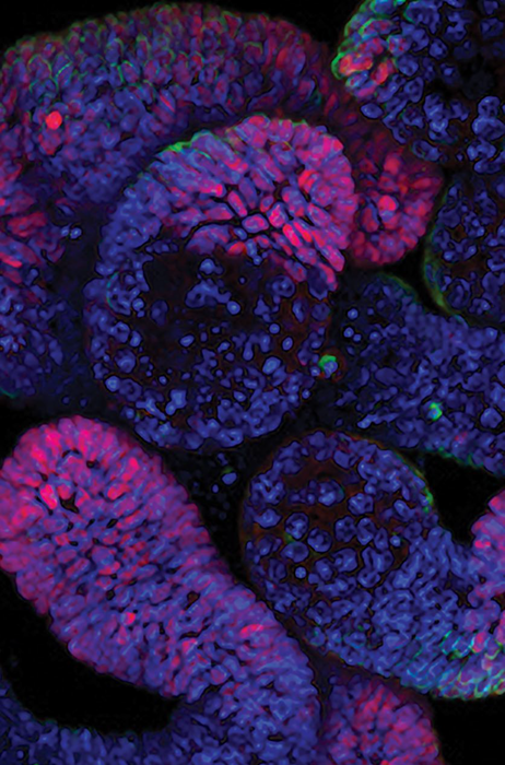 High-content analysis and its role in live-cell imaging