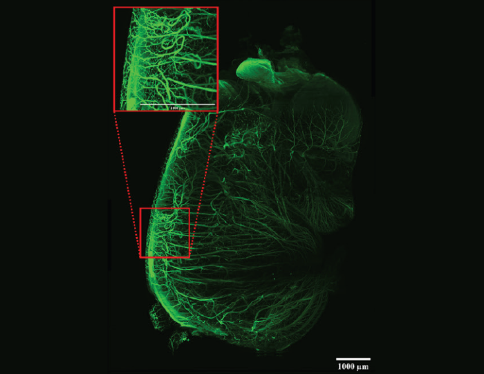 Developing nerves in a whole mouse embryo. The sample was cleared with DBE. Tiled image (3 x 4) acquisition. Scalebars: 1 mm. Imaged on the LCS SPIM. Sample courtesy of James Muller, MSKCC, New York, USA