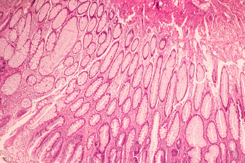 GaGe digitizers power high-resolution imaging in ultrasound and diagnostics