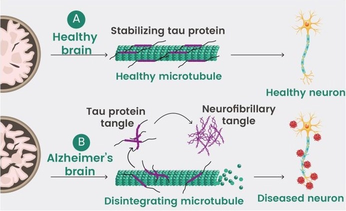 Physiological and Pathological Role of Tau Proteins