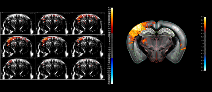 A typical compiled sequence of images acquired using fUS, showing the ‘lighting up’ of a part of the mouse brain as a result of whisker stimulation. The fact that blood flows in the brain can be in different directions within a small volume means that it’s better to image this activity using blood volume (using Power Doppler) rather than blood velocity (using color Doppler). However, our fUS– and microbubble-enabled ultrasound localization microscopy (ULM) technique – allows the actual blood velocities to be determined at high resolution should that information be needed