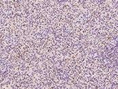 TREM proteins and reagents for targeted immunotherapy