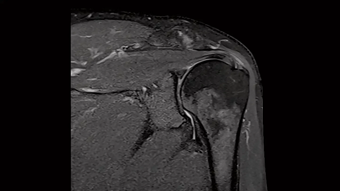 80 cm bore MAGNETOM Free.Max