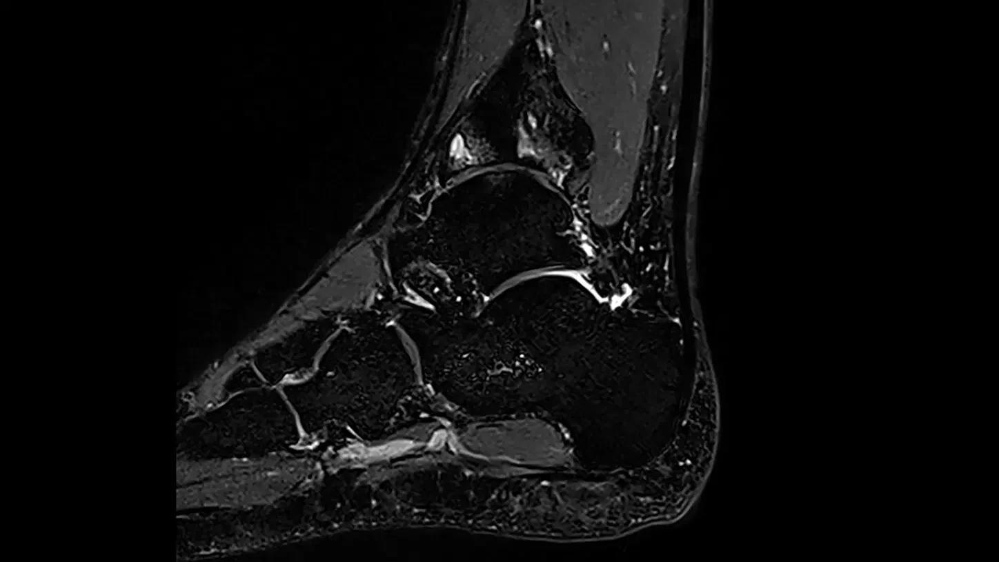 1.5T MRI system MAGNETOM Sola