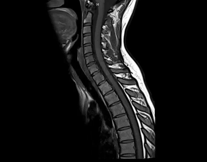 MAGNETOM Altea features and benefits