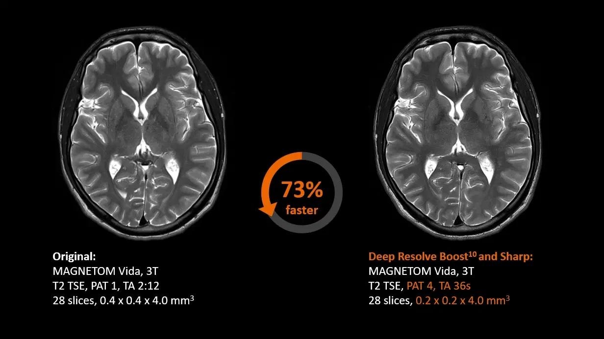 3T MRI scanner MAGNETOM Vida