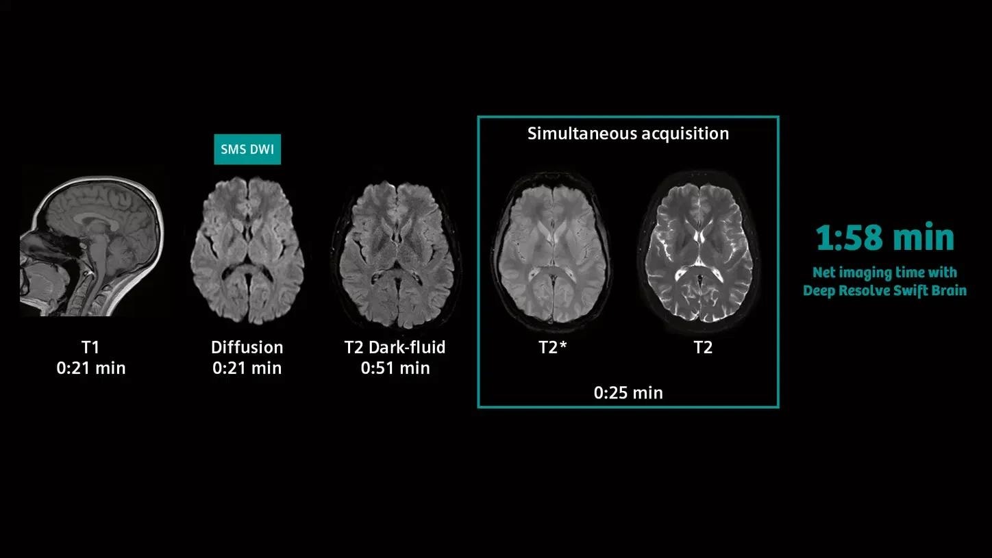 3T MRI scanner MAGNETOM Vida
