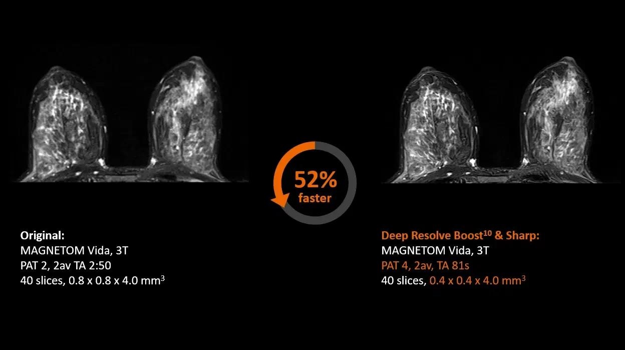 3T MRI scanner MAGNETOM Vida