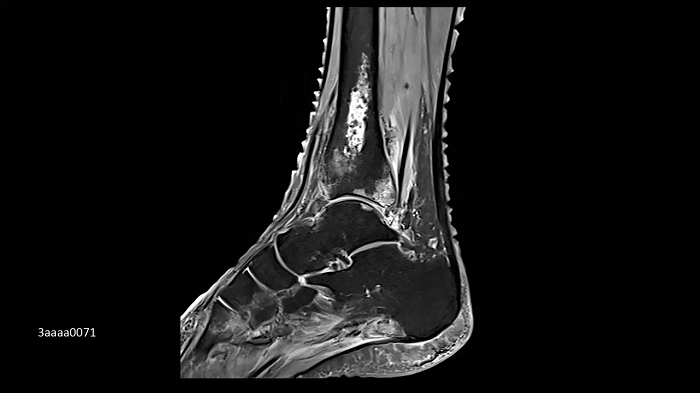 3T MRI scanner MAGNETOM Vida