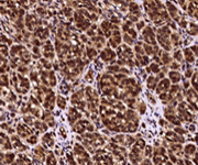 SCF/c-Kit signaling axis: Regulating cancer stemness