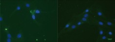 Immunostaining with an anti (His)6Tag antibody (green) of R28 cells treated with (His)6Tag E6-AChE (Cat#: 50543-M08H, Sino Biological). Cell nuclei are stained with DAPI (blue).