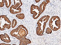 Immunochemical staining of human KLK3 in human prostate.