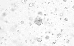 Human breast cancer organoids were cultured with FGF7 (Cat#: 10210-H07E), RSPO1 (Cat#: 11083-HNAS), IGF1 (Cat#: 10598-HNAE), EGF (Cat#: 50482-MNCH), NRG1 Beta 1 (Cat#: 11609-H01H), and NOG (Cat#: 50688-M02H).