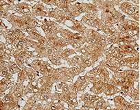 Immunochemical staining of human C5a in human cirrhosis.