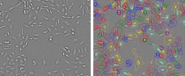 CellVoyager CQ1: An advanced cellular image analysis tool