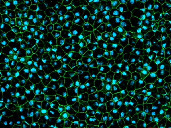 RPE cells displaying cobblestone morphology. Cells were immunolabeled with tight-junction ZO-1 marker (shown in green) and co-stained with nuclei marker, Hoechst (shown in blue)