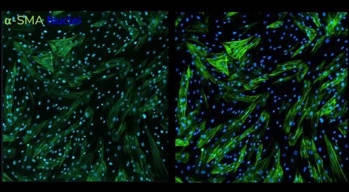 Increased resolution of laser-based acquisition. α-SMA staining following stimulation of human lung fibroblasts with TGF-β1 captured using LED-based imaging (left) vs laser-based imaging (right). Images taken at 20x magnification
