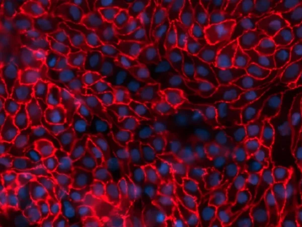 In vitro kidney disease modeling service