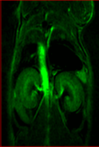 M-Series high-performance MRI