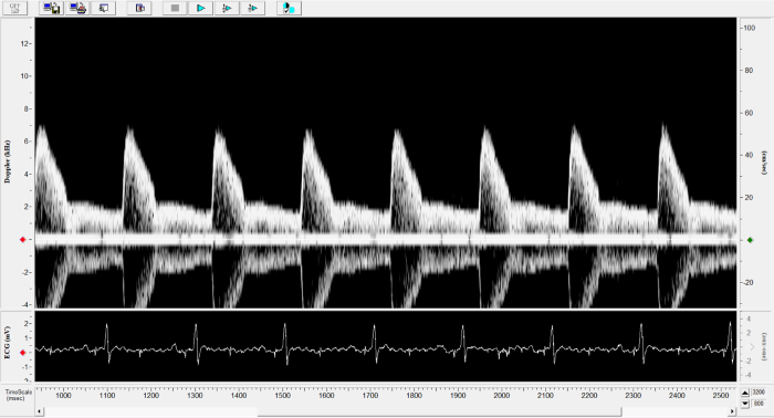 Rat - Abdominal Aorta