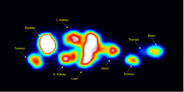 Mouse phantom filled with Tb-161 imaged with General Purpose collimator.